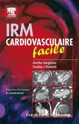 IRM cardiovasculaire facile